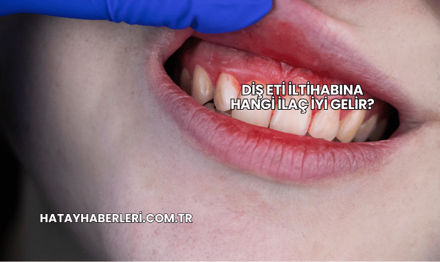 Diş Eti İltihabına Hangi İlaç İyi Gelir?