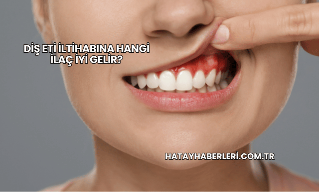 Diş Eti İltihabına Hangi İlaç İyi Gelir?