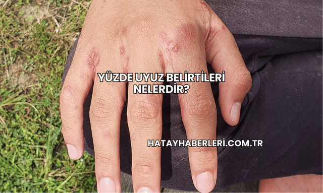 Yüzde Uyuz Belirtileri Nelerdir?